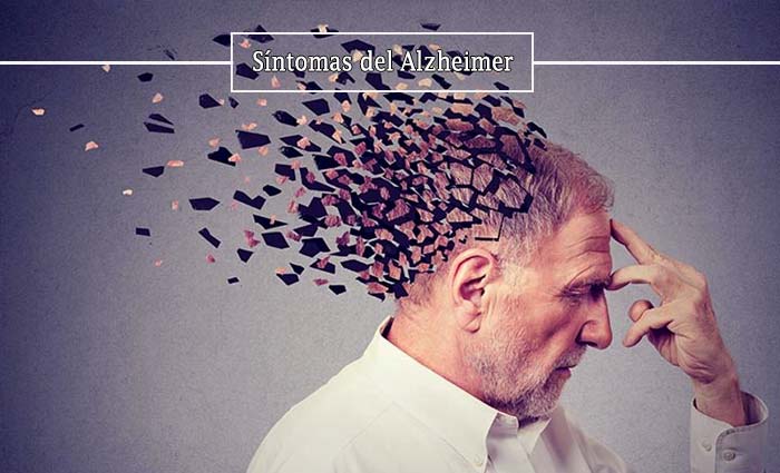 sintomas-del-alzheimer